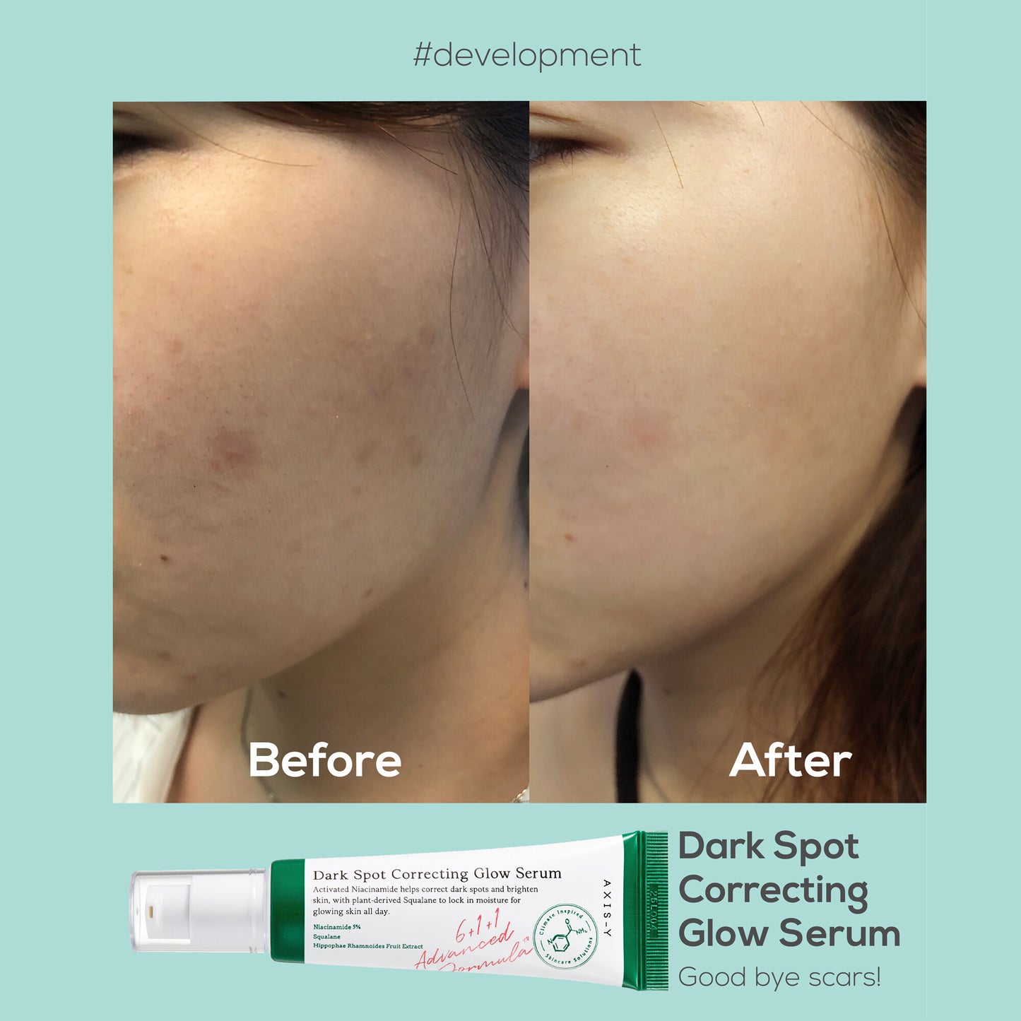 Shop AXIS-Y Dark Spot Correcting Glow serum Online in Pakistan - ColorshowPk