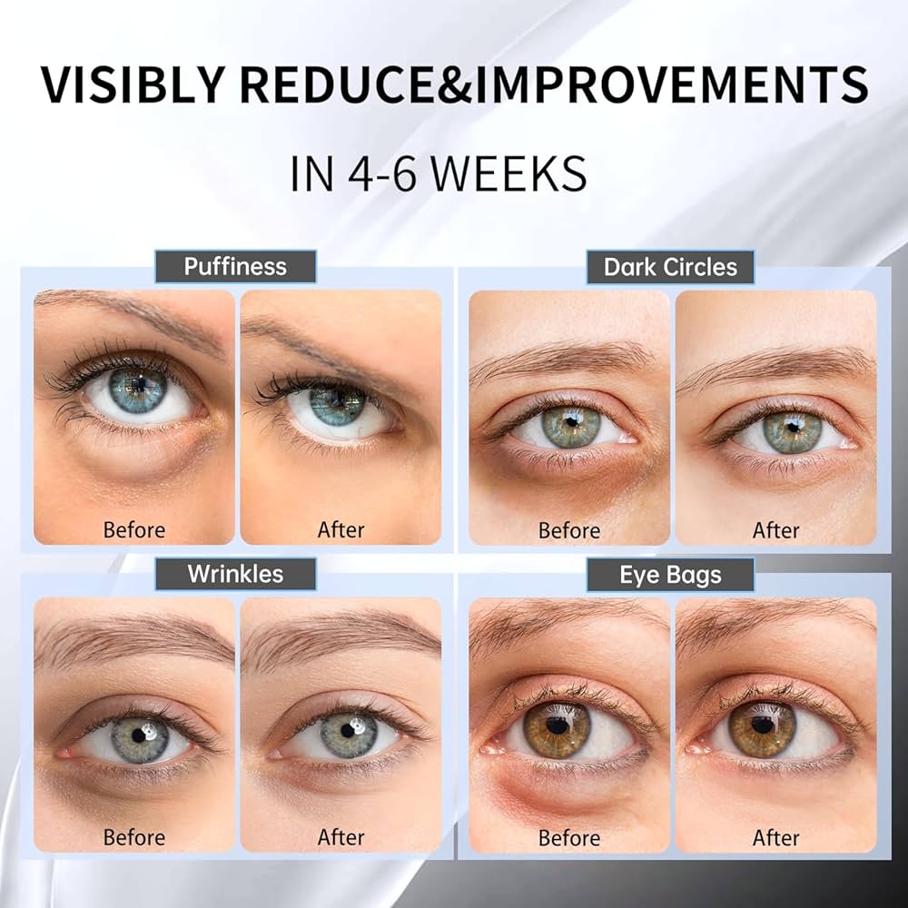 Cosrx Advanced Snail Hydrogel Eye Patch (60 patches)