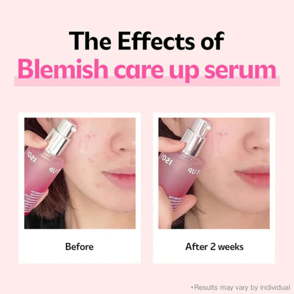 ISOI Blemish Care Up Serum