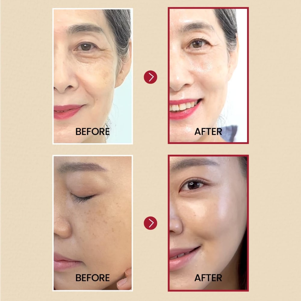 K-SECRET SEOUL 1988 Serum : Retinal Liposome 2% + Black Ginseng