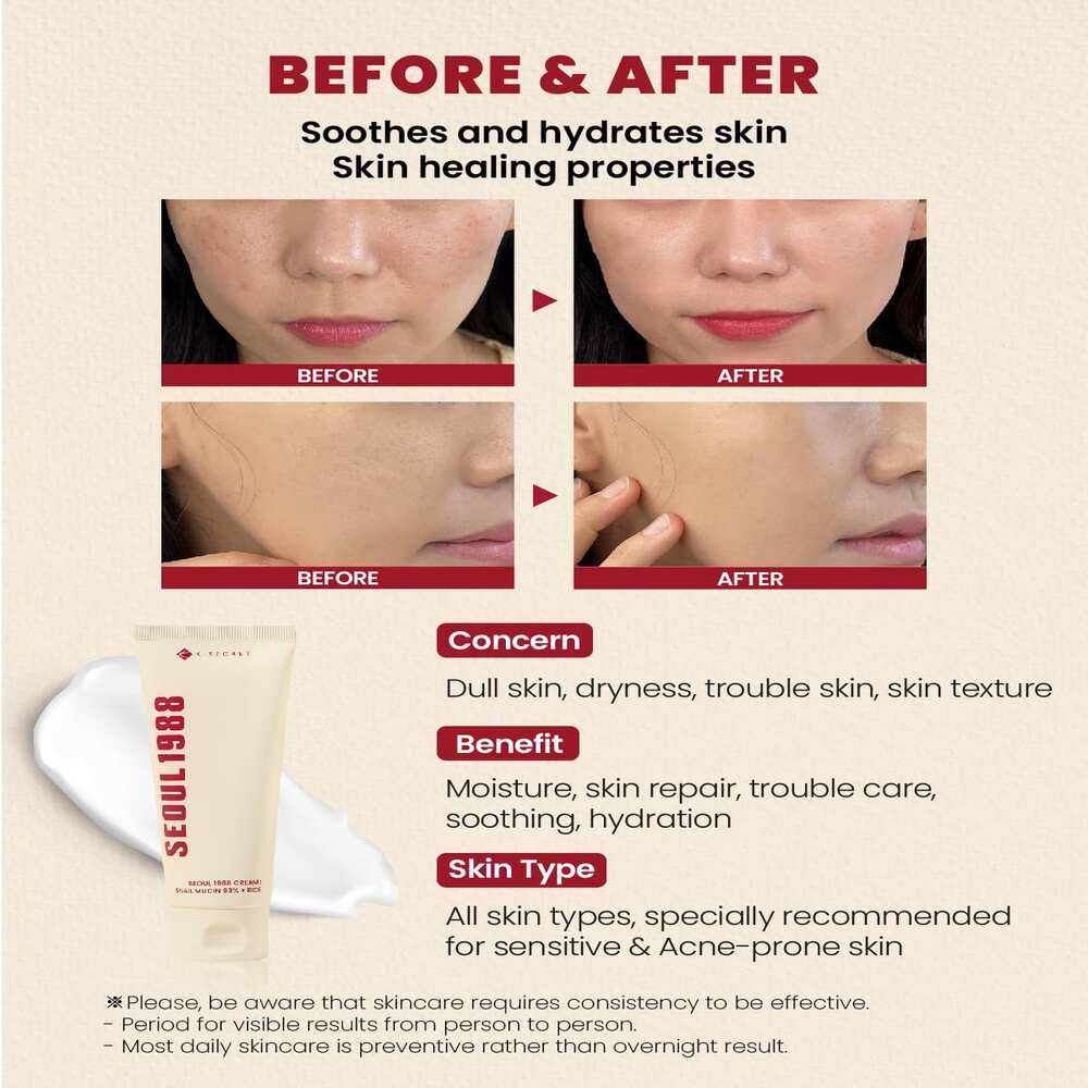 K-SECRET SEOUL 1988 Cream Snail Mucin 93% + Rice