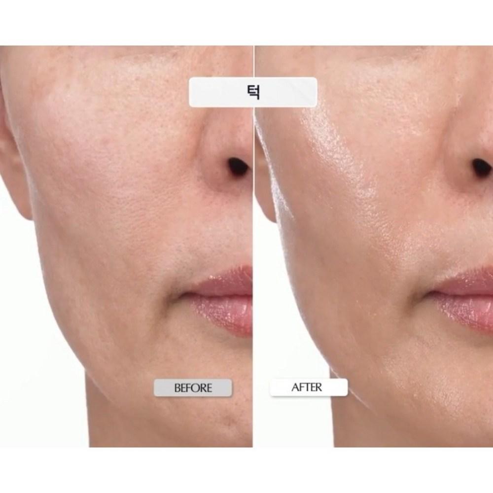 KOPHER Curepair Melder SOS System Mini