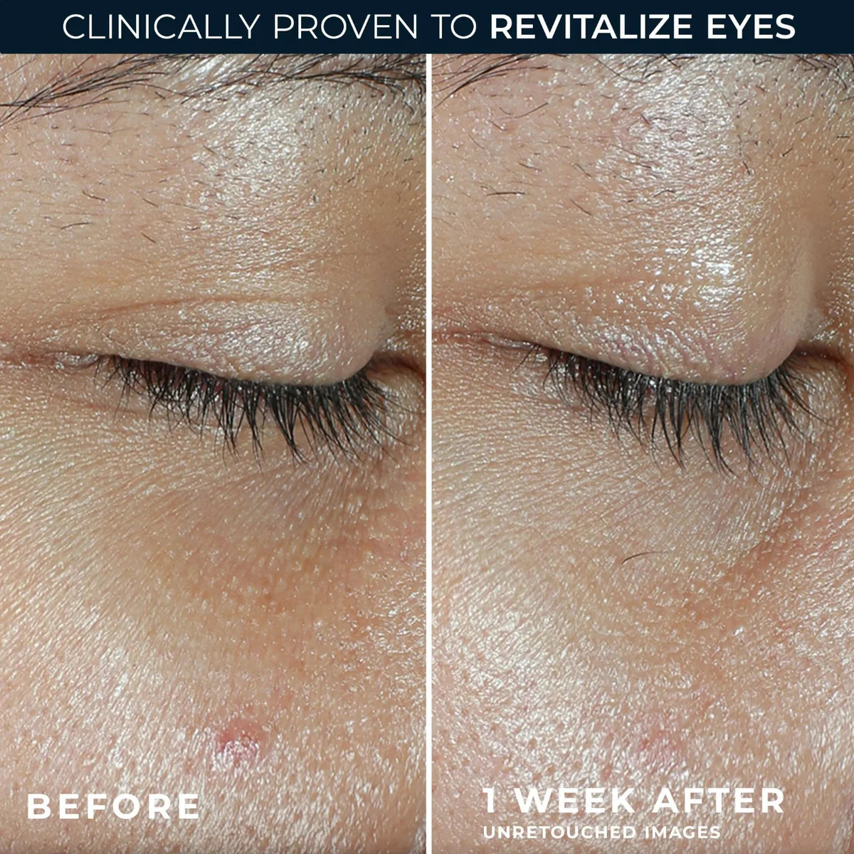 ROC MULTI CORREXION Revive + Glow Eye Balm 4g