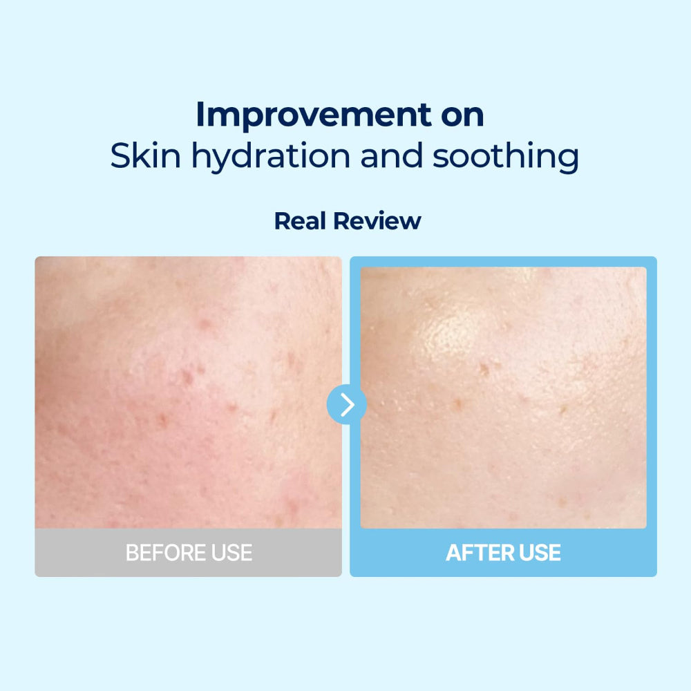 Torriden DIVE-IN Low Molecule Hyaluronic Acid Multi Pad (80ea)