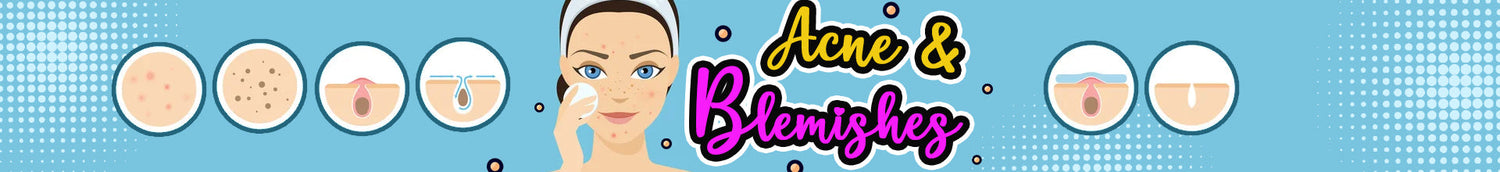 Acne Treatment & Blemishes in Pakistan