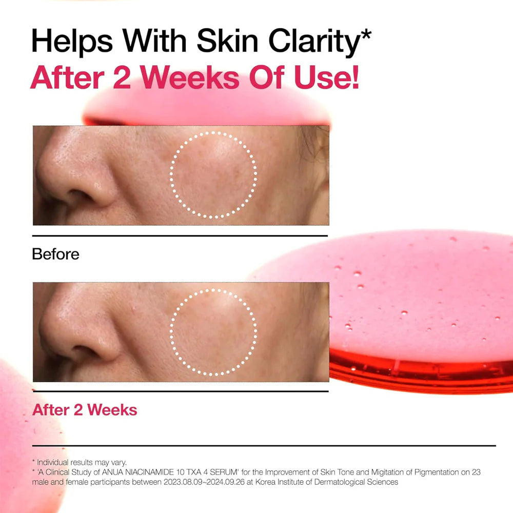Anua Niacinamide 10% + TXA 3%