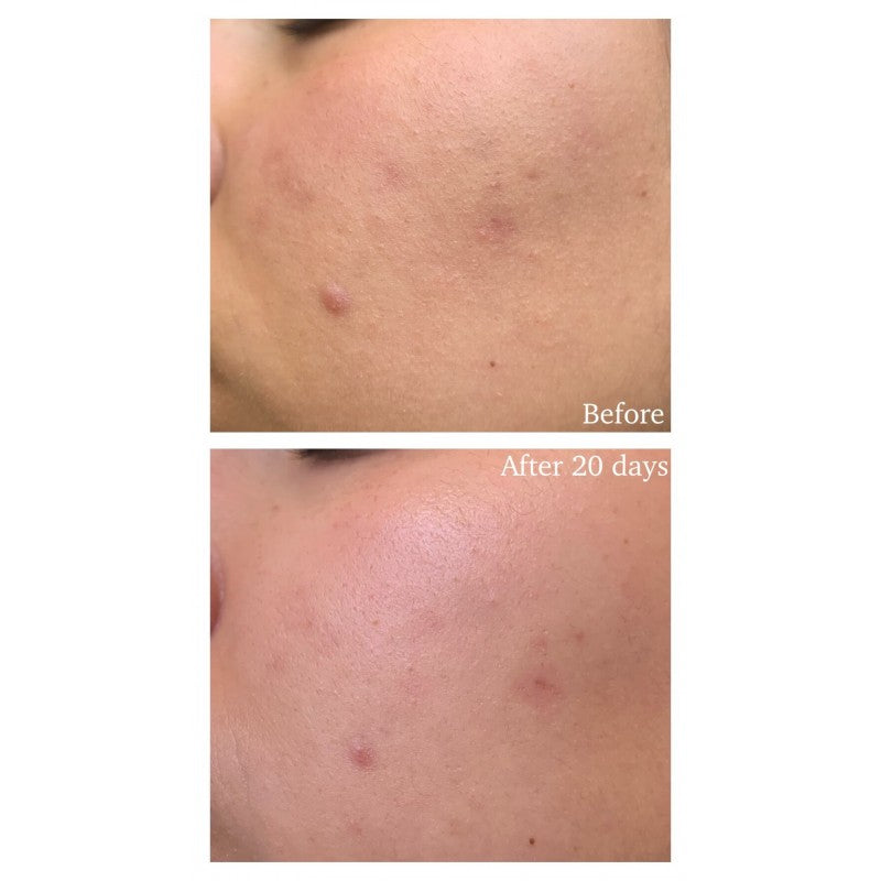 Glow Recipe Watermelon Glow PHA +BHA Pore-Tight Toner