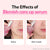ISOI Blemish Care Up Serum