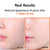 Isntree Hyper Niacinamide 20 Serum