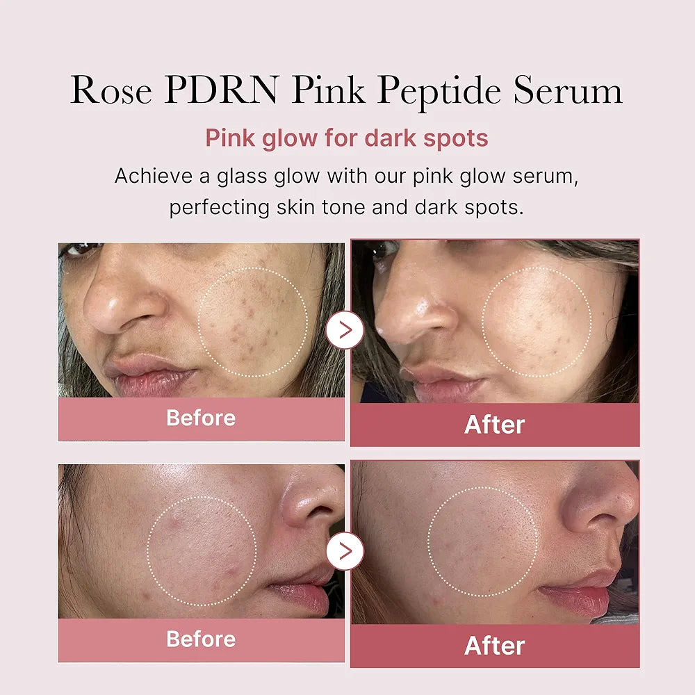 Medicube PDRN Pink Peptide Serum Ultra Light