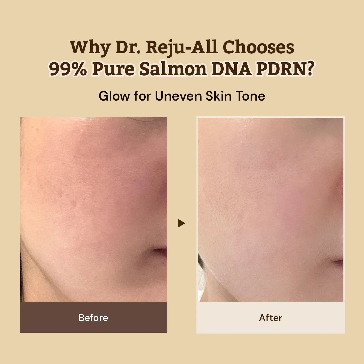 Dr. Reju-All Advanced PDRN Rejuvenating Cream
