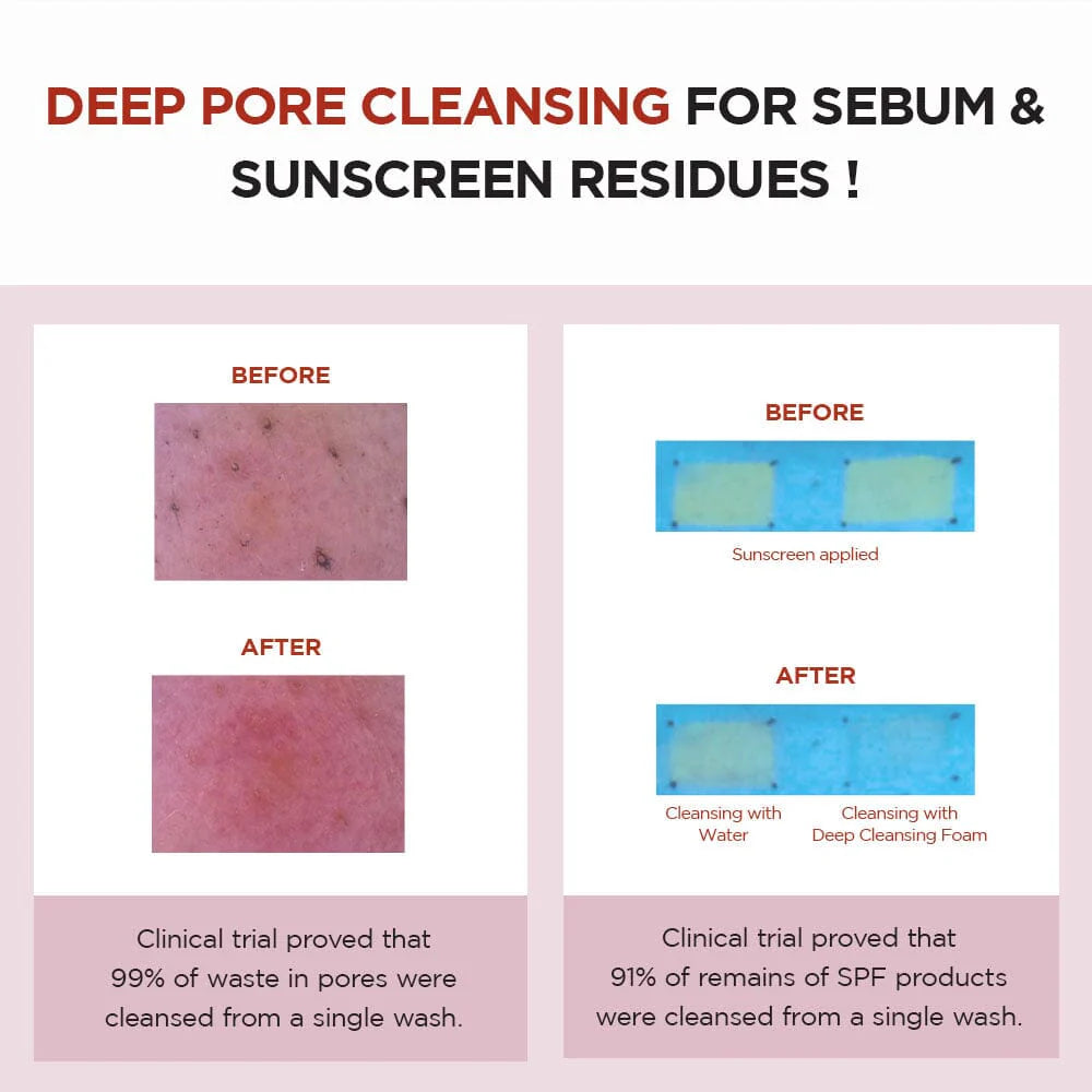 Skin1004 Poremizing Deep Cleansing Foam
