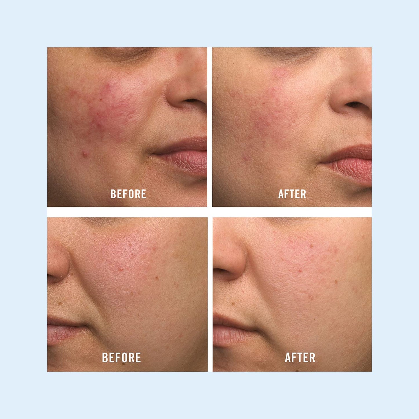First Aid Beauty Ultra Repair Cream Intense Hydration