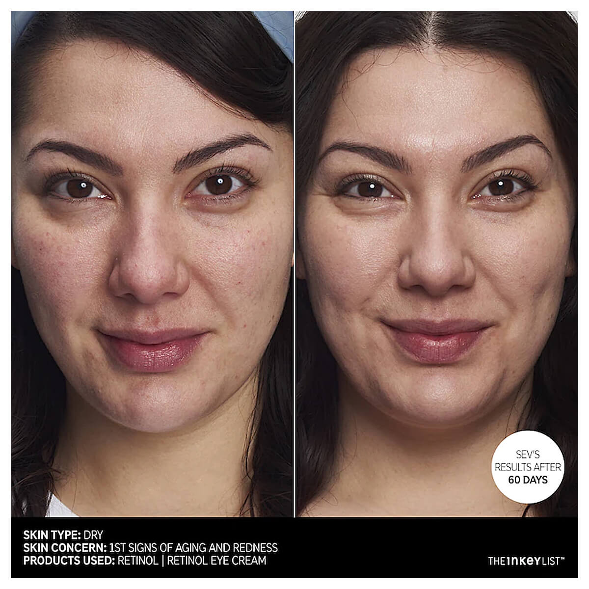 The INKEY List Retinol