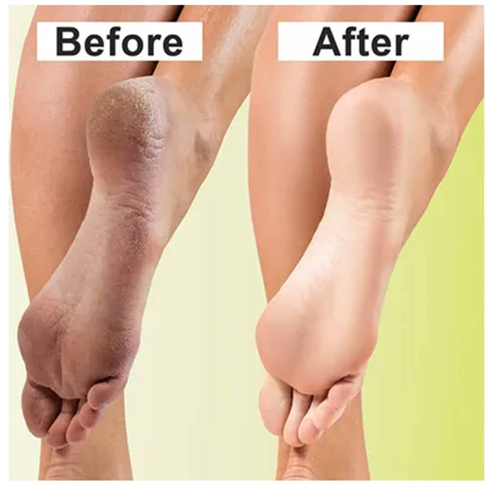 Vlcc lemon grass & walnut foot scrub ColorShow